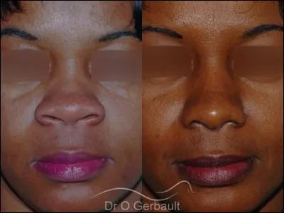 Un nez peut être busqué !