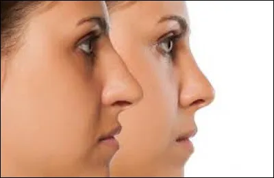 C'est une plante aquatique.