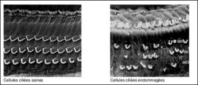 Nous savons maintenant comment l'organisme perçoit les sons. Mais il est nécessaire de rappeler que ce mécanisme n'est pas sans faille : il faut en prendre soin. En effet, notre exposition au bruit est à surveiller et peut être nocive pour nos oreilles, notamment nos cellules ciliées. Savez-vous à partir de quel niveau sonore on encourt des risques ?