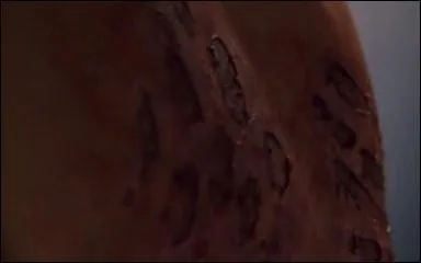 Lequel des jeunes gens a le dos ainsi marqu ?