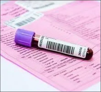 Que faut-il ajouter au mot "trans" pour trouver le nom d'un enzyme qui catalyse un type de r&eacute;action entre un acide amin&eacute; et un acide a-c&eacute;tonique ?