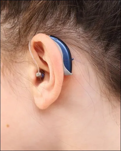 Les professionnels qui délivrent et adaptent les prothèses auditives sont :