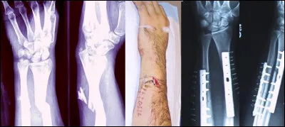 Message chiffré, c'est la...