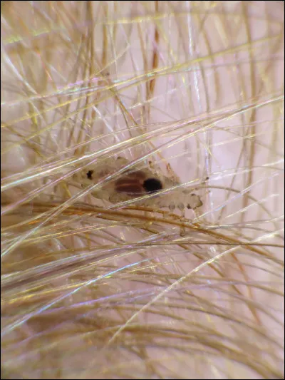 As-tu d&eacute;j&agrave; attrap&eacute; des poux ?