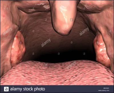 ______________ belle _____________.