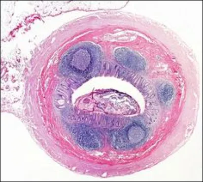 Où retrouve-t-on de l'épithélium pluristratifié ?