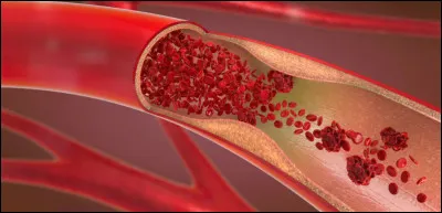 Existe-t-il un vaisseau sanguin appelé capillaire ?