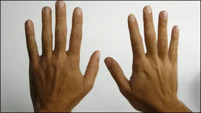 Les bras de Naruto (ses deux bardas) sont &agrave;...