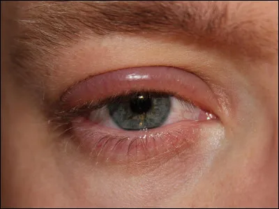 Poule ou cheval, c'est la...