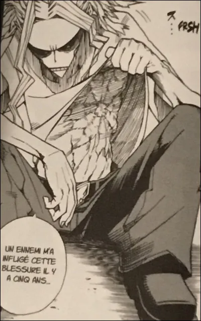 Qui a fait ce petit bobo de rien du tout au super héros ?