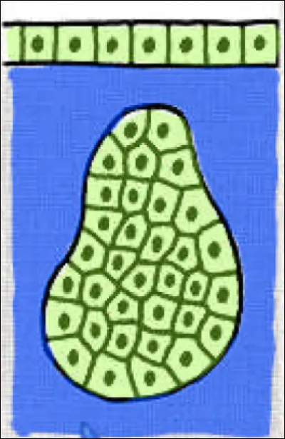 Quelle est cette glande ?