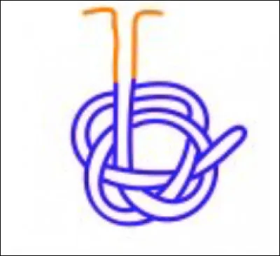 Quelle est cette glande exocrine ? Est-ce une glande simple ou une glande composée ?