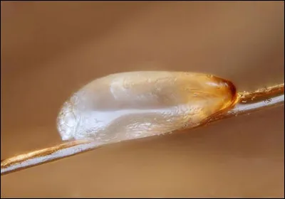 La lente est la larve de la puce. Info ou intox ?