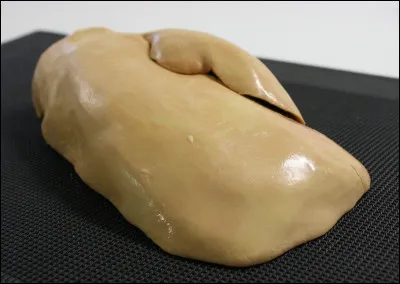 Qu'est ce qu'un foie gras de canard en terme médical ?