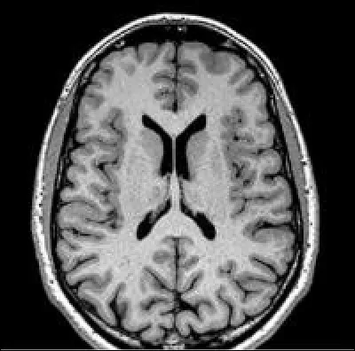 Ceci est une coupe :