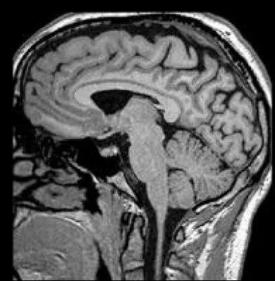 Ceci est une coupe :