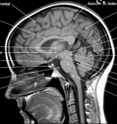 Ceci est une coupe :