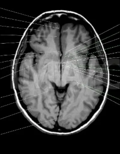 Ceci est une coupe :