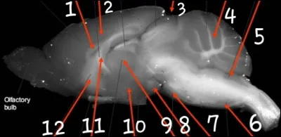 Le num&eacute;ro 10 est :