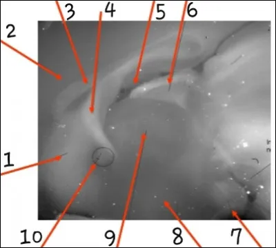 Le num&eacute;ro 3 est :