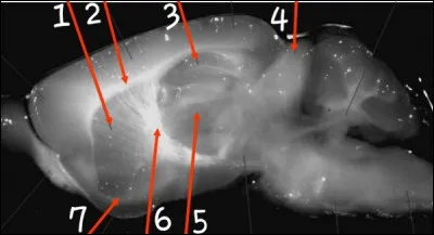 Le num&eacute;ro 4 est :