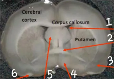 Le num&eacute;ro 5 est :