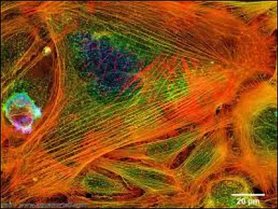 À propos des microfilaments d'actine :