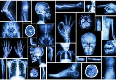 Quels examens sont basés sur la radiologie ?