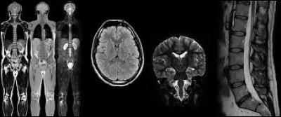 À part la radiologie, il existe également la médecine nucléaire. Cochez les réponses vraies à son propos !