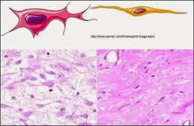 La star des cellules du tissu conjonctif est sans aucun doute le fibroblaste ! Saurez-vous reconnaître les propositions vraies à son égard ?