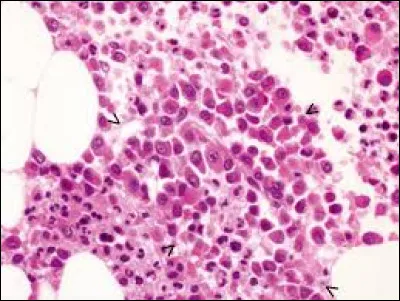 Quels propos sont faux concernant les plasmocytes ?