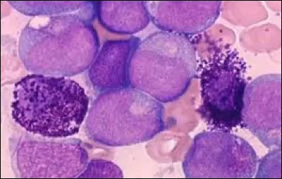 À propos du mastocyte :