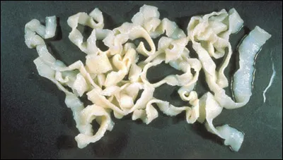 Combien peut mesurer un taenia (vert plat) chez l'homme ?