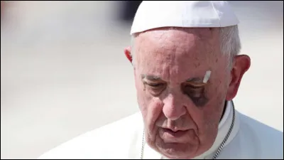 Je marchais tranquillement dans la rue quand ce gars m'a attaqué, sûrement un voyou, oh mais je ne me suis pas laissé faire, je lui ai mis ... !