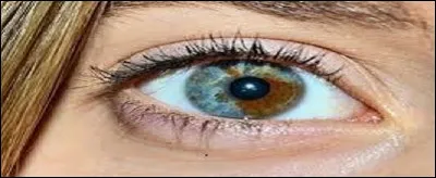 Certains yeux ont des couleurs magnifiques. 
Quel nom porte celle de l'illustration ?