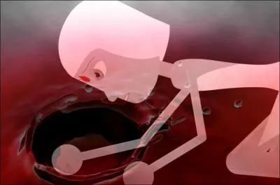 Pourquoi Slne tait  l'hopital ?