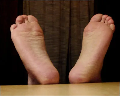 Comment appelle-t-on la phobie des pieds ?