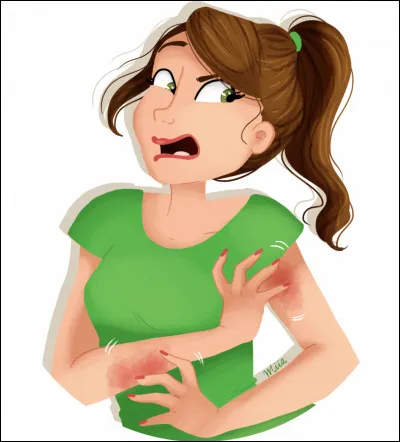 Orthographe simplifiée de ''eczéma'' :