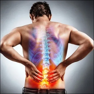 Quelle inflammation frappe un organe de la zone iléo-cæcale ?