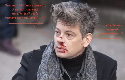 Voilà ce qui arrive, quand on se prend pour Gainsbourg... Il ne l'a pas volé, non ?