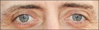 À quel humoriste appartiennent ces yeux ?