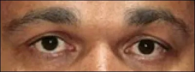 À quel humoriste appartiennent ces yeux ?