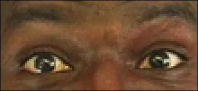 À quel humoriste appartiennent ces yeux ?