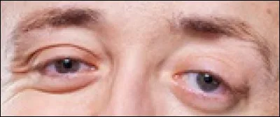 À quel humoriste appartiennent ces yeux ?