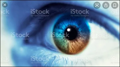 Qu�elle est ta couleur de yeux, si tu as une maladie qui change la couleur de tes yeux &ccedil;a sera toujours celle d�origine : )