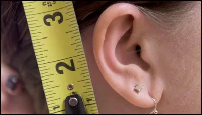 Le lobe possède-t-il du cartilage ?