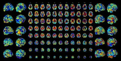 Combien de neurones possède l'être humain ?