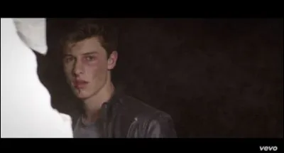 Comment dit-on "points de suture" en anglais ?