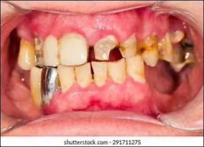 Penses-tu que tu pourrais survivre sans te brosser les dents ?