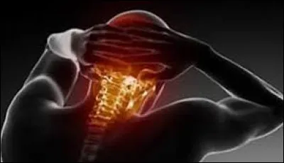 Sciences : combien l'être humain compte-t-il de vertèbres cervicales ?